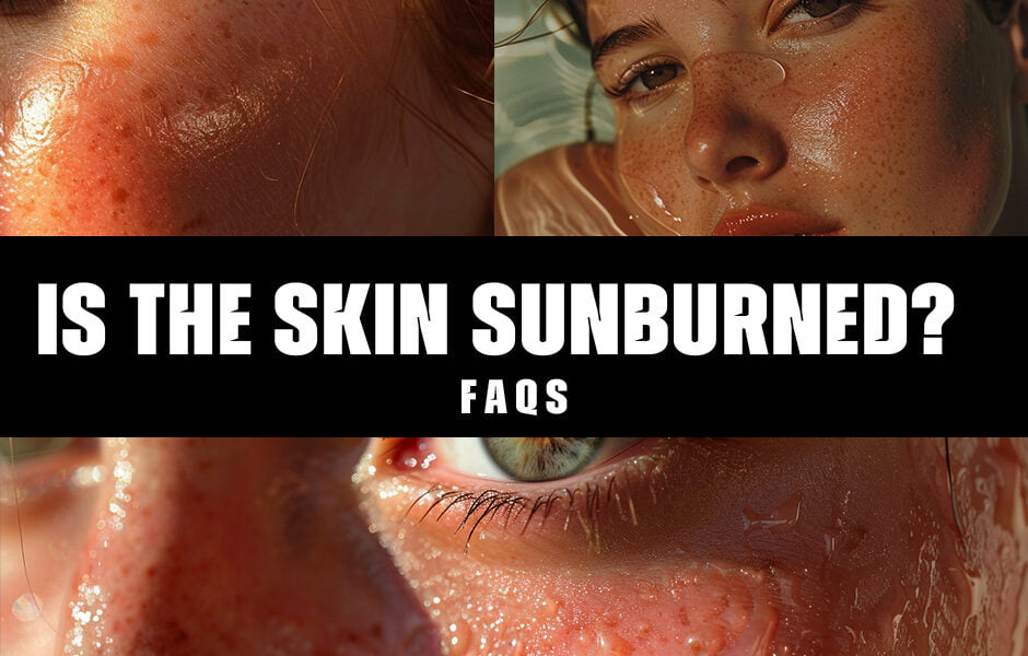 Is it safe to get a tattoo while your skin is sunburned?